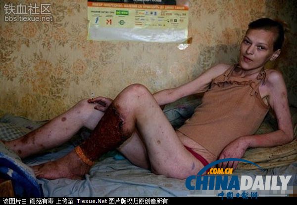 美麗蛻變!實(shí)拍吸毒女孩的戒毒歷程