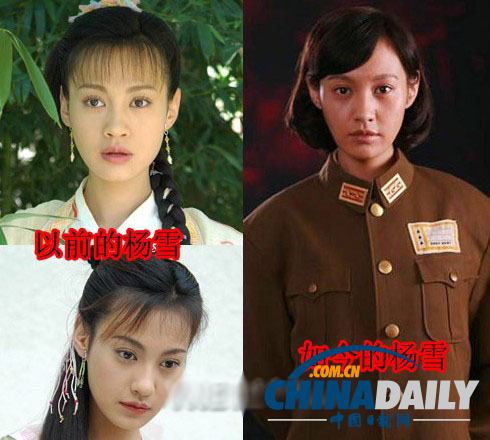 柳巖李小璐楊冪 女星整容前驚人對比照