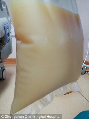 中山男子腹痛緊急送醫(yī)搶救，檢出“牛奶血”！